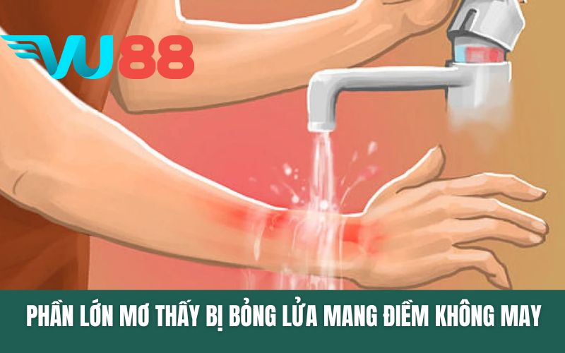 Phần lớn mơ thấy bị bỏng lửa mang nhiều điềm không may